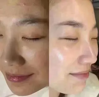 マツエク・マツパ aliaハイフ&水光ジェットサロン所属・aliaハーブ水光店 エステティシャン募集のエステ・リラクイメージ