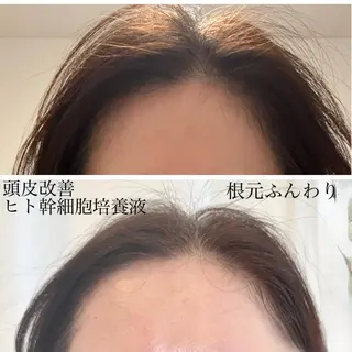 mire（ミレ） トータルビューティーのエステ・リラクイメージ