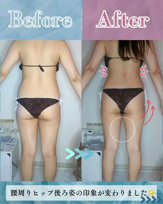 痩身ハーブピーリング 筋膜リリース☆B&Hのエステ・リラクイメージ