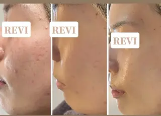 Ange -viva la vida-所属・Ange vivalavidaのエステ・リラクイメージ