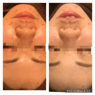 ミディアム パーマ ヘアアレンジ メンズ キッズ ネイル マツエク・マツパ アイブロウ アニメ,Vオタク× 即効痩せエステサロンのエステ・リラクイメージ