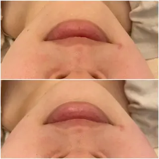 ララ/ハーブ メゾンリュバンのエステ・リラクイメージ