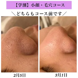 Bellesthe （ベルエステ）のエステ・リラクイメージ