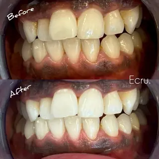 メンズ ホワイトニングサロン Ecru所属・ホワイトニングサロン Ecru エクリュのエステ・リラクイメージ