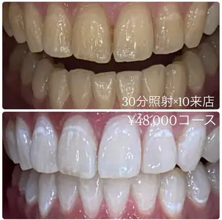 PLATINUM Beauty 横浜店所属・ホワイトニングルーム 横浜店のその他イメージ