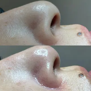 セルフエステエンリケ明石大久保店所属・夕希リンパ&痩身& 脱毛&毛穴ケアのエステ・リラクイメージ