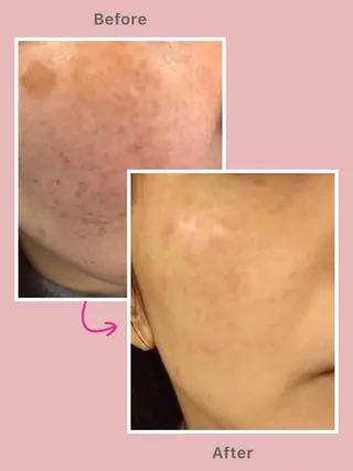 ELEGANCE所属・メンズ脱毛サロン BRIGHTのエステ・リラクイメージ