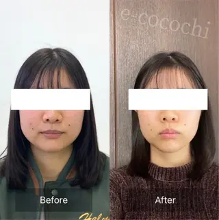 小顔と ヘッドスパのお店のエステ・リラクイメージ