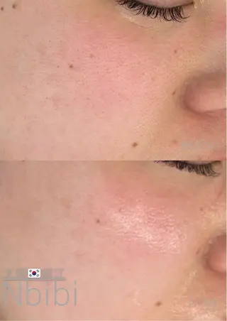 韓国🇰🇷価格 サロン_Nbibiのエステ・リラクイメージ