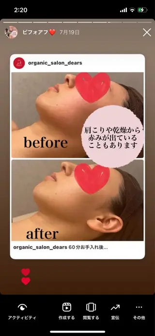 Dears /道後/フェイシャルのエステ・リラクイメージ