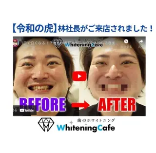 ホワイトニングカフェ徳島沖浜店所属・ホワイトニングカフェ 徳島沖浜店のエステ・リラクイメージ