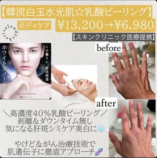 Salon de cheri サロンドシェリ人形町店所属・毛穴のお悩み・シミ 松本瞳のエステ・リラクイメージ