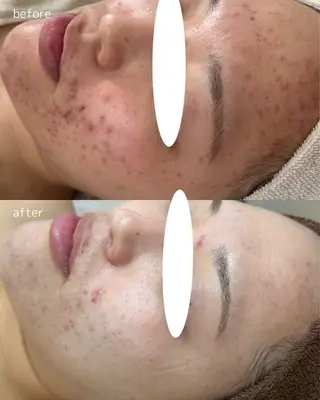 渡邊 千夏のエステ・リラクイメージ