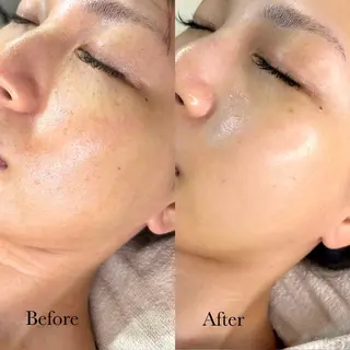 CHILO 銀座店のエステ・リラクイメージ