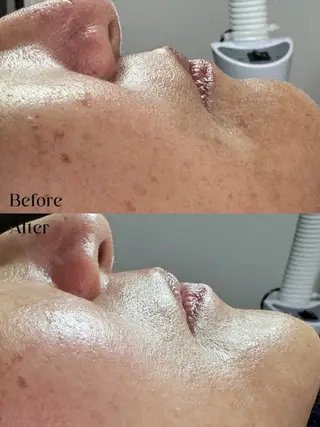 Hit. シュガーリング豊橋のエステ・リラクイメージ