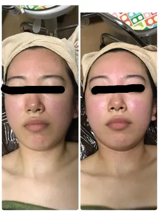 トータルエステサロン Tiaraのエステ・リラクイメージ