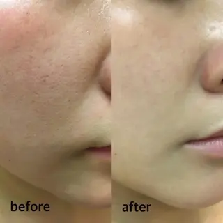 nail salon reposのエステ・リラクイメージ