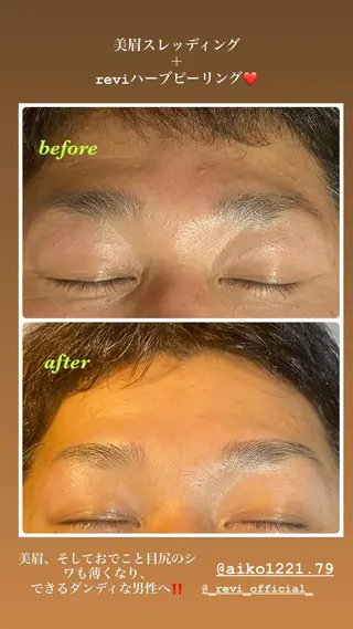 アイブロウ ハーブピーリング/韓国肌管理/フェイシャル/毛穴洗浄/眉毛/顔脱毛【糸脱毛専門】rev所属・ハーブピーリング🌹 毛穴洗浄❤️眉waxのエステ・リラクイメージ