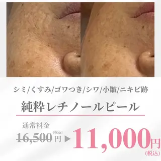 ALIA Scintiller  アリアサンティエ所属・齋藤 祐里耶のエステ・リラクイメージ