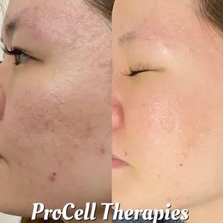 メンズ private salon Aola所属・プライベートサロン アオラのネイルデザイン