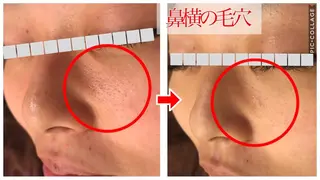 ショート カラー パーマ ヘアアレンジ メンズ キッズ ネイル マツエク・マツパ 四つ星サロン🎖 腸＆ニキビケアに特化のエステ・リラクイメージ