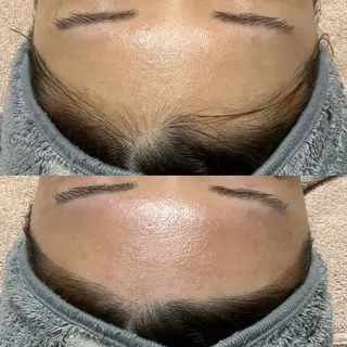 脱毛サロンBloom所属・脱毛屋さん/池袋 /Bloom🍋わだのエステ・リラクイメージ