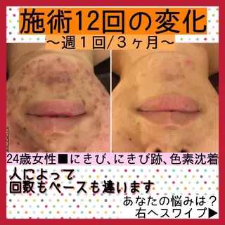 ミディアム カラー パーマ ヘアアレンジ メンズ キッズ ネイル マツエク・マツパ アイブロウ ニキビ・肌質改善専門 ♡人生が変わるサロンのエステ・リラクイメージ