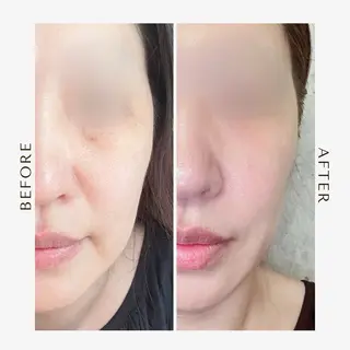 be living 真実のエステ・リラクイメージ