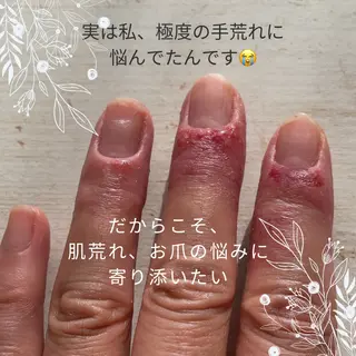 ネイル 荒井 恵のネイルデザイン