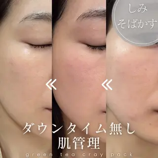 美肌salon GRAN CUORE所属・Natsuki🌙 GRAN CUOREのエステ・リラクイメージ