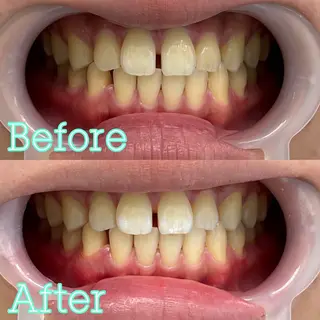 歯のホワイトニング専門店 MIGAQ 京都四条大宮店所属・佐藤 未来の眉毛・アイブロウイメージ