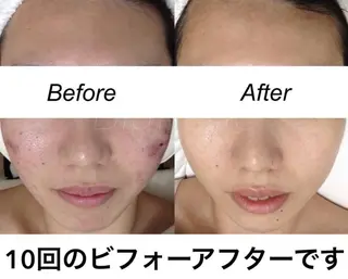 ショート カラー パーマ ヘアアレンジ キッズ ネイル マツエク・マツパ 都度払い肌質改善 &脱毛Blancheのエステ・リラクイメージ