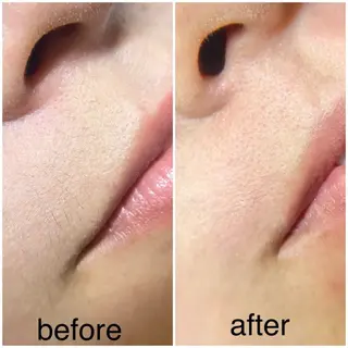 ニキビケア&毛穴改善サロン GLOW所属・GLOW フェイシャルサロンのエステ・リラクイメージ