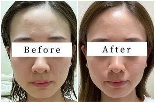 ハーブピーリング専門 muro.のエステ・リラクイメージ