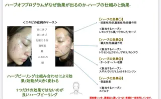 脱毛エステサロン PEAKのエステ・リラクイメージ