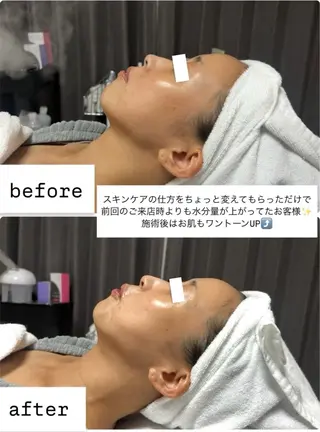 ROR Akariのエステ・リラクイメージ