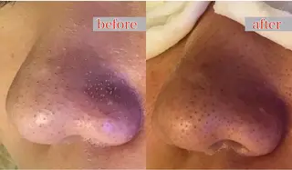 BeautySalon　heart所属・Beauty Salonheartのエステ・リラクイメージ