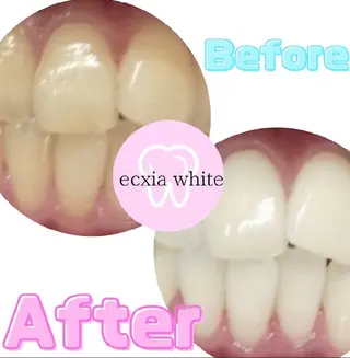 エクシアホワイトニング草津店所属・nanami -ホワイトニングのその他イメージ