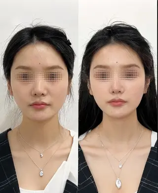 aliaハイフ&水光ジェットサロン所属・aliaハーブ水光店 エステティシャン募集のエステ・リラクイメージ