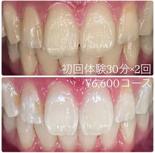 PLATINUM Beauty 横浜店所属・ホワイトニングルーム 横浜店のその他イメージ