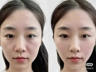 ネイル aliaハイフ&水光ジェットサロン所属・aliaハーブ水光店 エステティシャン募集のエステ・リラクイメージ