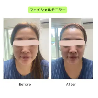 beauty EMELY名古屋のエステ・リラクイメージ