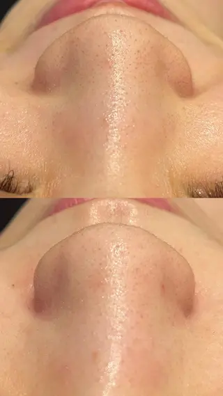 Lilyboo 池袋のエステ・リラクイメージ