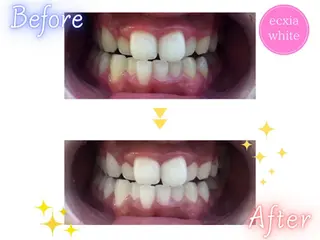 セルフホワイトニング エクシア鶴岡店のその他イメージ