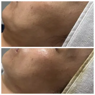 AmeliLab所属・Fujimoto Erinaの眉毛・アイブロウイメージ