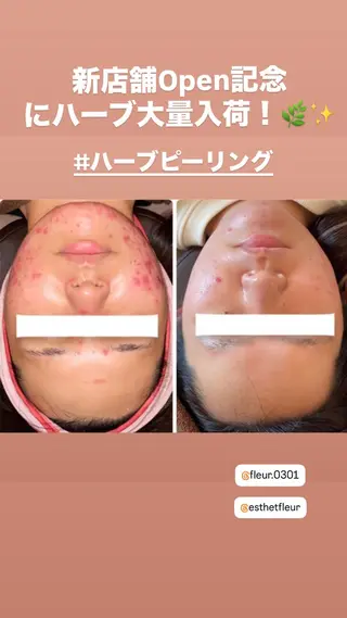 FLEUR 2号店のエステ・リラクイメージ