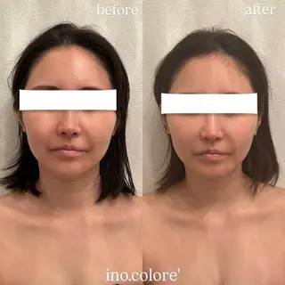 エステサロンino.colore'所属・小顔サロン ino.coloreのエステ・リラクイメージ