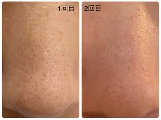 デ・アイム　西船橋所属・吉永玲奈 ニキビ/毛穴/シミのエステ・リラクイメージ