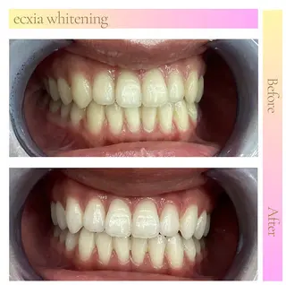 ecxia  white 　広島袋町店所属・セルフホワイトニング エクシア広島袋町店のその他イメージ