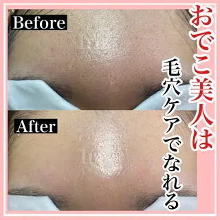 Aki 似合わせまつ毛💎のエステ・リラクイメージ